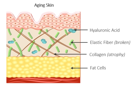 parts of the aging skin